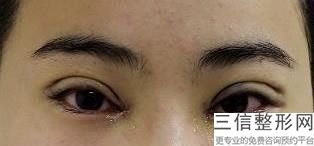 上海排名前十眼部整形医院评选结果公示,上海市前3名整形医院