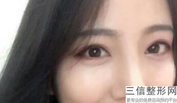 上海排名前十眼部整形医院评选结果公示,上海市前3名整形医院