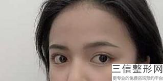 上海排名前十眼部整形医院评选结果公示,上海市前3名整形医院