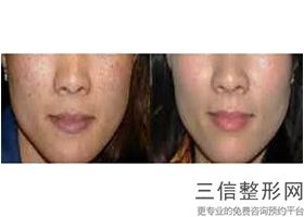 上海皮肤科排名前十的大医院,上海皮肤科排名前十的大医院上海天气预报