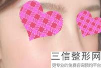 上海权威鼻子整形医院排名前五公布,上海哪个医院鼻整形好