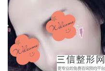 上海权威鼻子整形医院排名前五公布,上海哪个医院鼻整形好