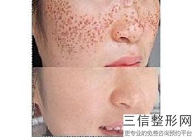 上海热玛吉官方授权医院排行榜四强,上海热玛吉认证医院
