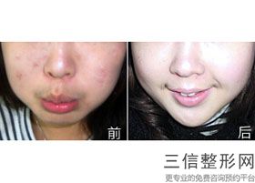 上海热玛吉官方授权医院排行榜四强,上海热玛吉认证医院