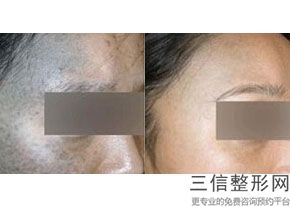 上海热玛吉认证机构和认证医生实力推荐,热玛吉官方认证机构上海