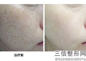 上海热玛吉认证机构和认证医生实力推荐,热玛吉官方认证机构上海