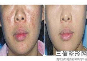 上海热玛吉认证机构和认证医生实力推荐,热玛吉官方认证机构上海
