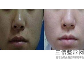 上海热玛吉认证机构和认证医生实力推荐,热玛吉官方认证机构上海