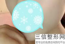 上海市做嘴唇整形医院排行榜前五位,上海哪家医院做嘴唇手术好一点
