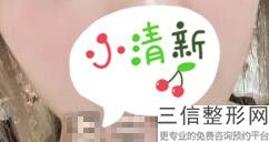 上海市做嘴唇整形医院排行榜前五位,上海哪家医院做嘴唇手术好一点