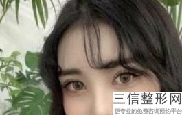 上海双眼皮修复较好的医院有哪些,上海双眼皮修复医院排名