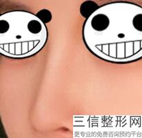 隆鼻子手术过程，简单的隆鼻手术