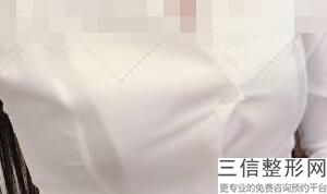 隆胸手术整形医院，隆胸好的整形医院