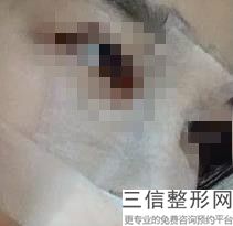哪家整形医院做隆鼻良好，隆鼻哪家整容医院比较好
