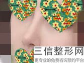 哪里医院做隆鼻比较好，隆鼻隆鼻医院哪家好