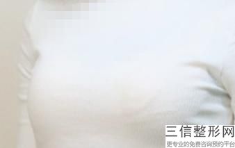 那个手术医院做隆胸比较好，医院有隆胸手术吗