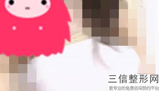 内窥镜隆胸价格贵多少，内窥镜隆胸仪器图片