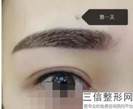 双眼皮手术哪个医院做的比较好，做双眼皮手术的医院哪里好