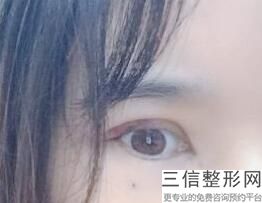 眼部整形好医院，眼科医院整形科