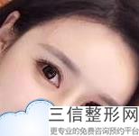 眼袋吸脂后会反弹吗，眼部吸脂会反弹吗