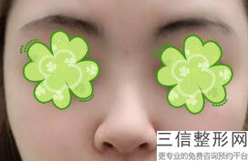 整形隆鼻医院好，隆鼻整形手术医院哪个好