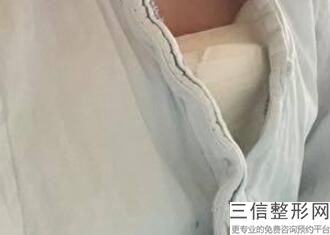做假体隆胸的价格，做假体隆胸多少钱呢