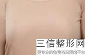 做隆胸手术需要多少钱，隆胸手术大概要多少钱
