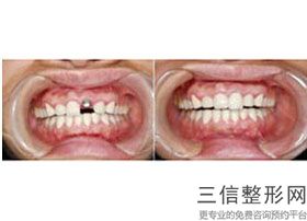 重庆口腔医院有哪些,2022重庆美奥口腔位列前十