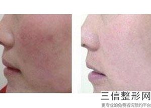 重庆拉皮手术医生排行榜权威八强评选,2022金城郁医生实力非凡