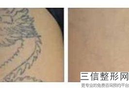 重庆拉皮医院的排名榜前五公开了,2022重庆军科整形医疗美容位列前十