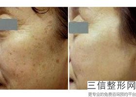 重庆拉皮医院排行榜前十,2022重庆美仑美奂整形医院锁定前十