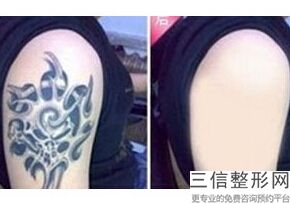 重庆拉皮医院排名榜前十口碑实力盘点,2022重庆星荣整形医院口碑良好