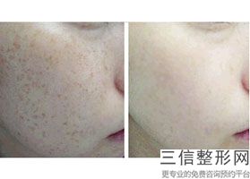 重庆拉皮医院排名前七公布,2022 重庆市第三人民医院整形美容科首次上榜