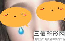 重庆隆鼻排名前十的医生口碑盘点,2022 朱家旭实力上榜