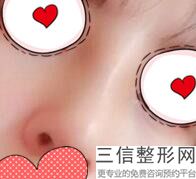 重庆隆鼻排名前十的医生名单,2022毕胜医生首次上榜