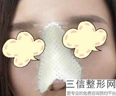 重庆隆鼻医生排名前七被选定,2022范文亮博士实力非凡