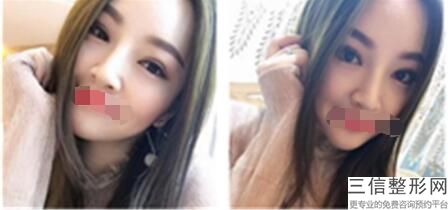 重庆隆鼻整形医院排行榜前十深度点评,2022重庆华美整形美容医院不容错过
