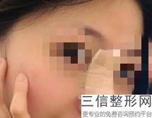 重庆隆鼻整形医院排名前十,2022 重庆百达丽美容门诊部首次上榜