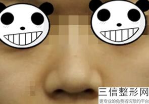 重庆隆鼻整形医院排名前四,2022重庆天艺美整形美容医院锁定前十