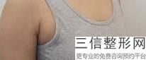 重庆隆胸整形医院排名前十,2022重庆美仑美奂整形美容医院口碑不错