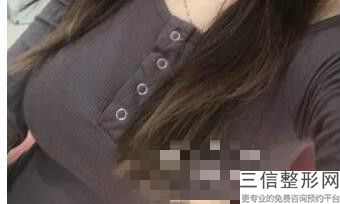 重庆隆胸整形医院排名前四权威汇总,2022重庆华美整形美容医院不容错过