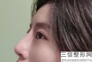 重庆哪家医院看眼科好,2022重庆医科大学附属第一医院眼科排名靠前