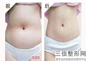 重庆哪里丰胸比较好,2022重庆西南整形医院位列前十
