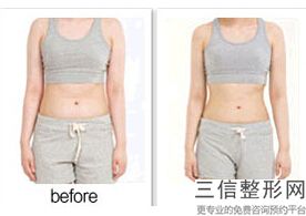 重庆哪里医院丰胸比较好,2022重庆哪家医院丰胸比较好排名如下实力非凡
