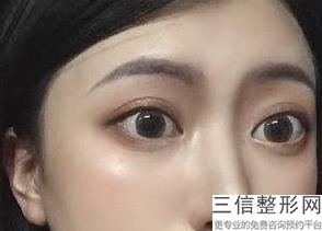 重庆去眼袋整形医院排名前八,2022重庆合川亚美医疗美容诊所排名靠前