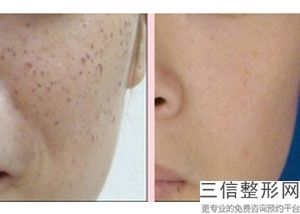 重庆热玛吉官方授权医院有哪些,2022重庆星宸医疗美容实力非凡