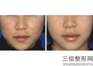 重庆热玛吉授权医院排行榜前五家,2022重庆晶肤整形美容医院口碑良好