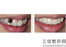 重庆十大牙科医院排名榜,2022重庆韩佳牙博士口腔医院口碑良好