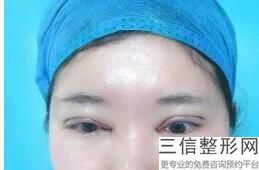 重庆十大眼科整形医院新鲜出炉,2022 重庆医科大学附属第一医院不容错过