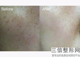 重庆十大整形医院哪家拉皮好,2022重庆新铜雀台整形医院位列前十